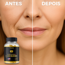 Hialuroni Caps – Colageno Hidrolisado com Ácido Hialurônico